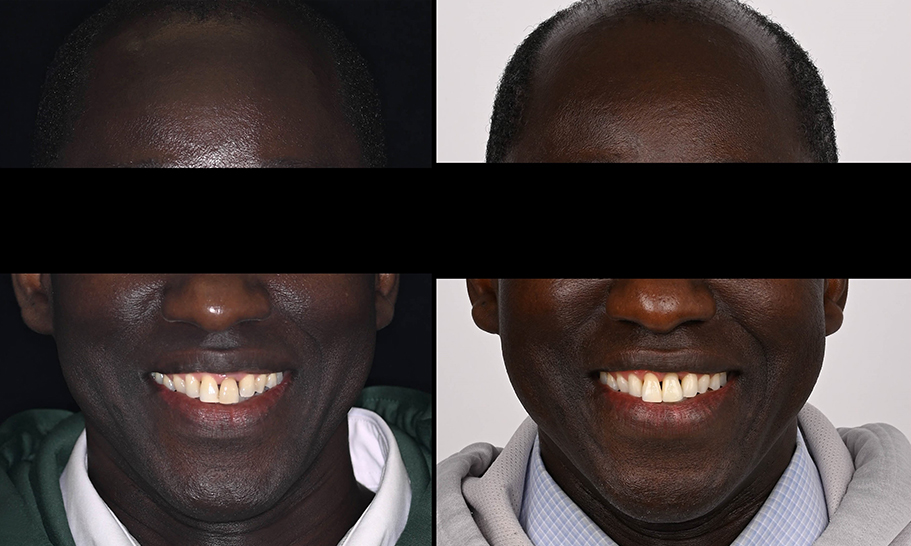 Full face_Abouzeid (4)