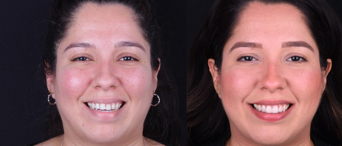 Full face_Alvarado