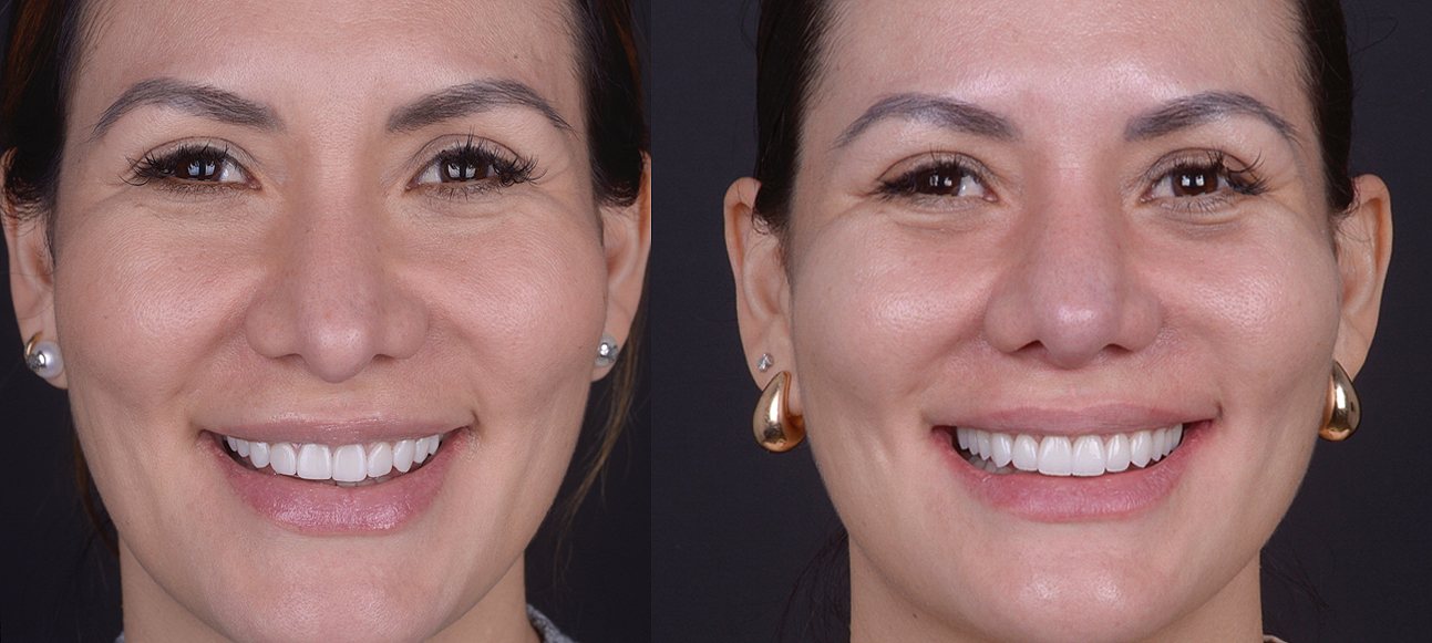 Full face_DeAguiar