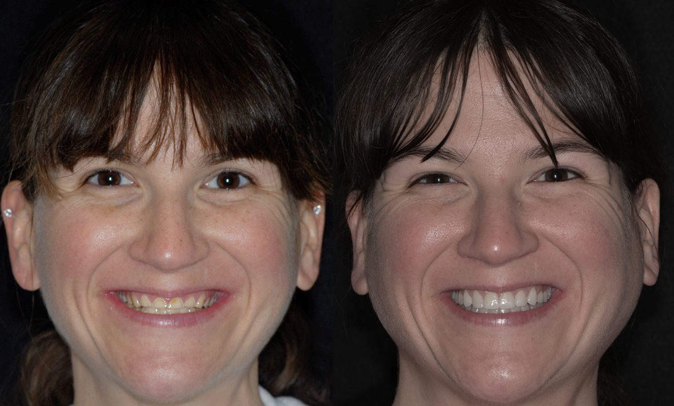 Full face_Gatta