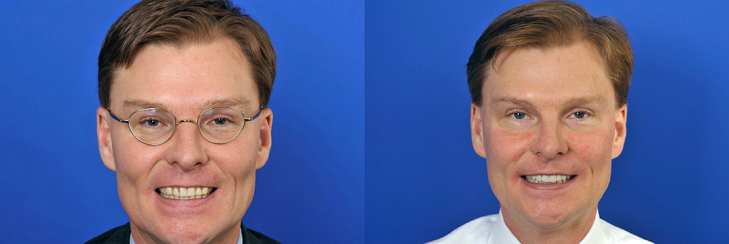 Full face_Rickert