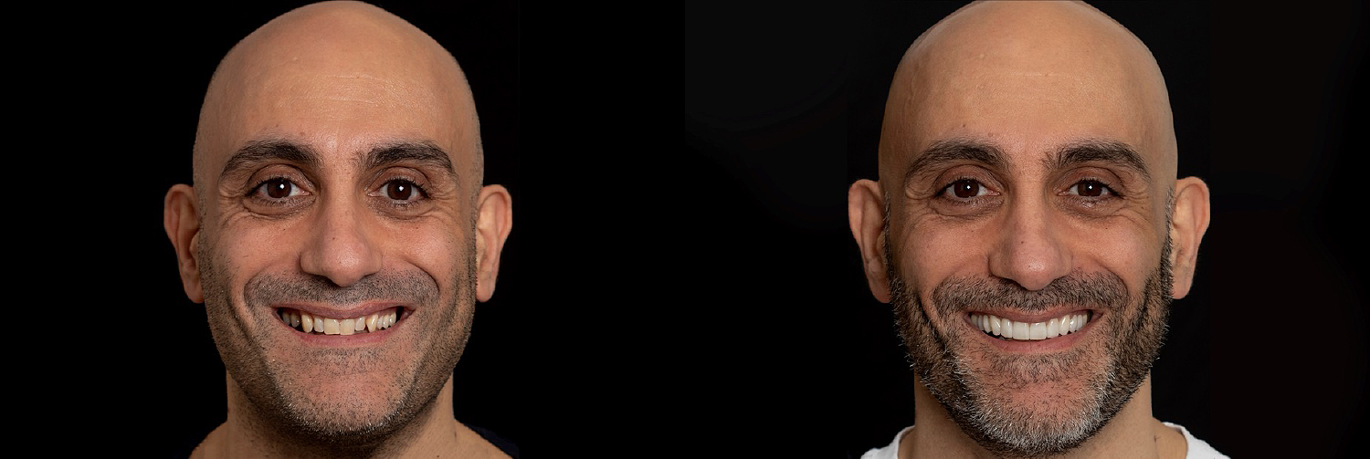 Full face_Sealey