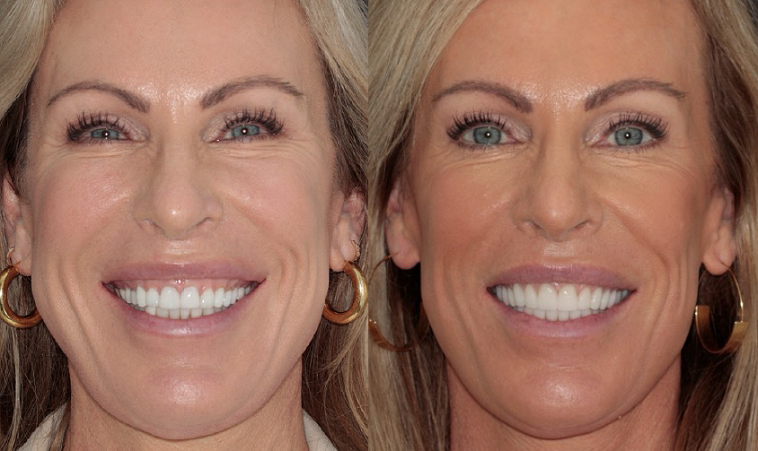 Full face_Wooddell