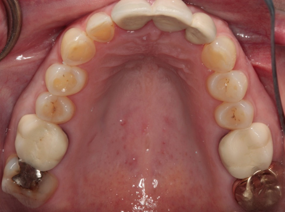 Occlusal2_Woodell