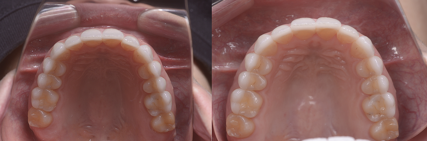 Occlusal_DeAguiar