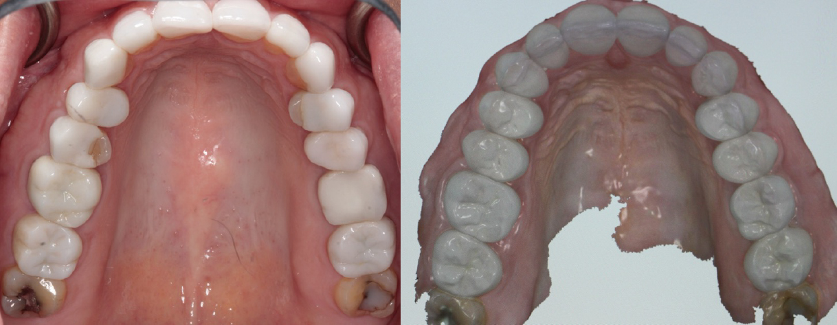 Occlusal_Wooddell