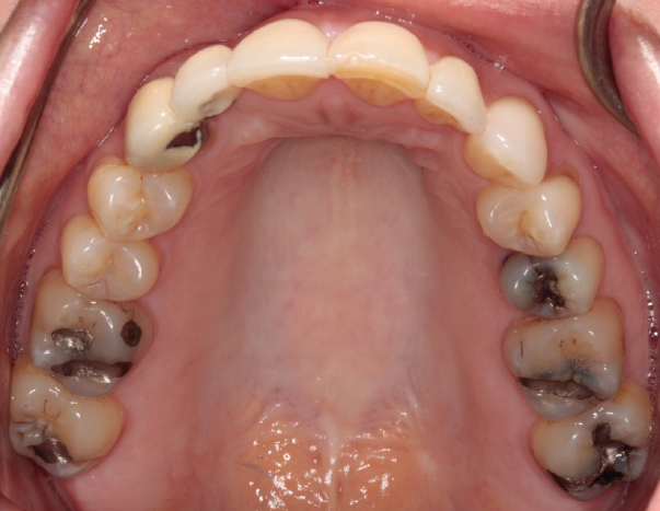 Occlusal_Woodell