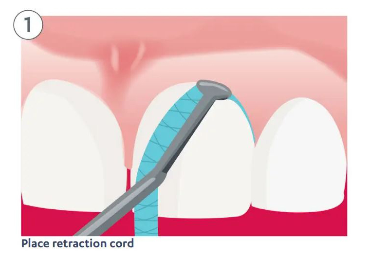 Intraoral Scanning and Treatment Quality: What Accuracy Studies Tell Us ...